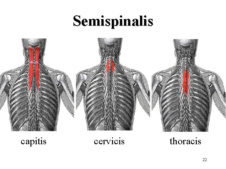 Semispinalis capitis cervicis thoracis 22 