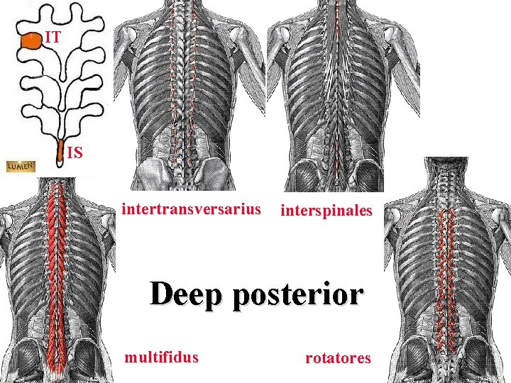 IT IS intertransversarius interspinales Deep posterior multifidus rotatores 23 IT IS intertransversarius interspinales Deep posterior multifidus rotatores 23