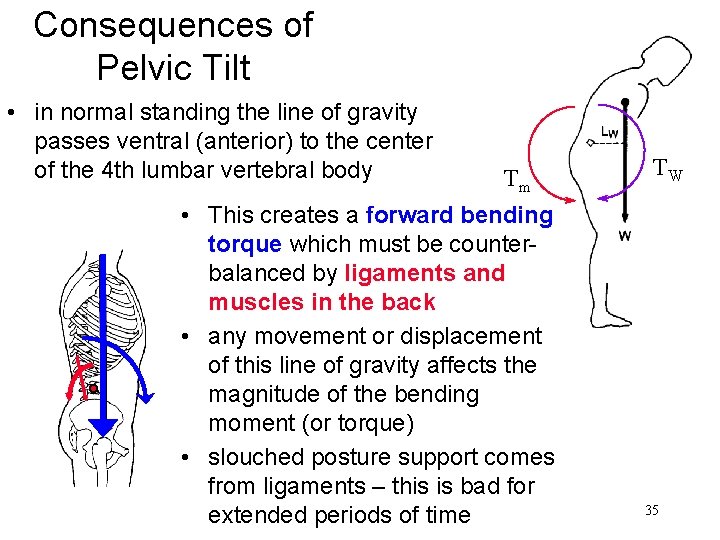 Consequences of Pelvic Tilt • in normal standing the line of gravity passes ventral