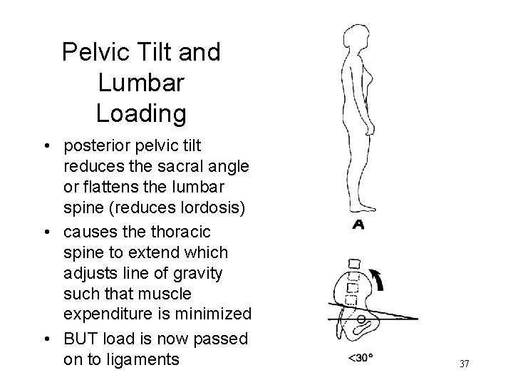 Pelvic Tilt and Lumbar Loading • posterior pelvic tilt reduces the sacral angle or