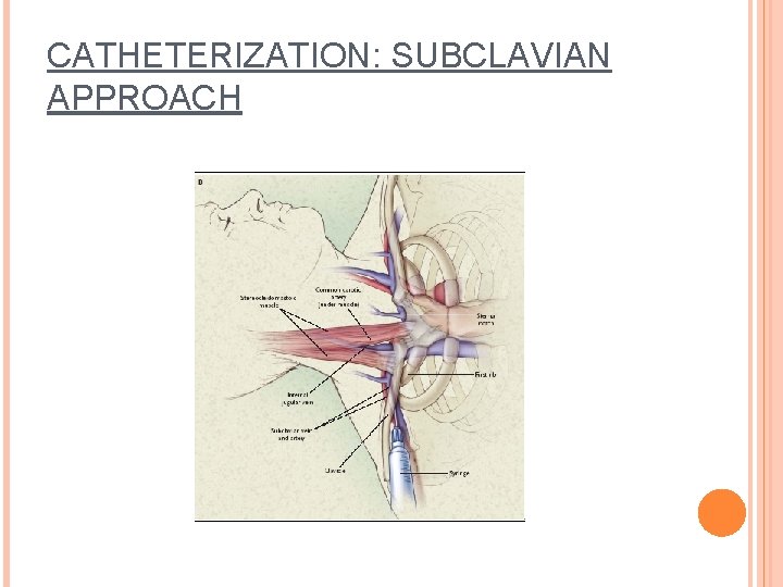 CATHETERIZATION: SUBCLAVIAN APPROACH 