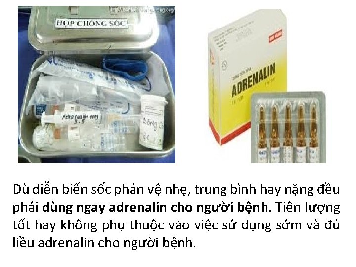 Dù diễn biến sốc phản vệ nhẹ, trung bình hay nặng đều phải dùng