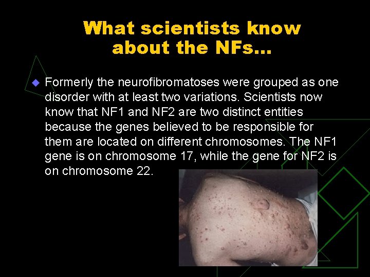 What scientists know about the NFs. . . u Formerly the neurofibromatoses were grouped