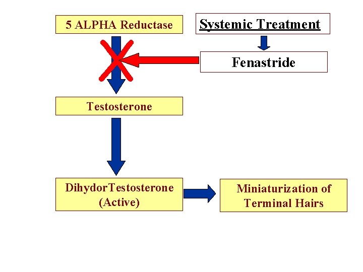 5 ALPHA Reductase X Systemic Treatment Fenastride Testosterone Dihydor. Testosterone (Active) Miniaturization of Terminal
