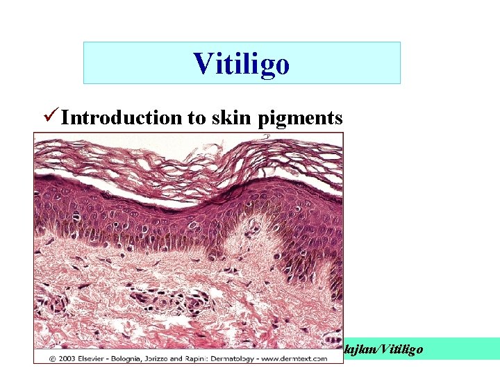 Vitiligo ü Introduction to skin pigments Alajlan/Vitiligo 