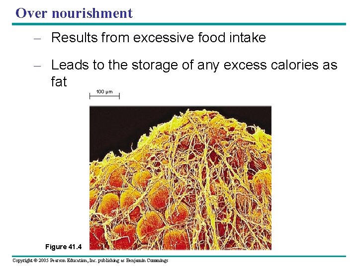 Over nourishment – Results from excessive food intake – Leads to the storage of