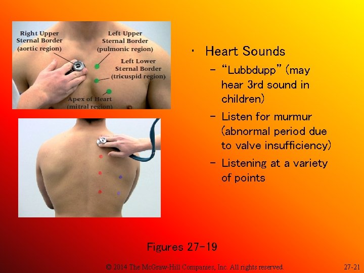  • Heart Sounds – “Lubbdupp” (may hear 3 rd sound in children) –