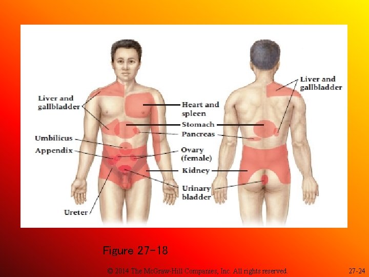 Figure 27 -18 © 2014 The Mc. Graw-Hill Companies, Inc. All rights reserved. 27