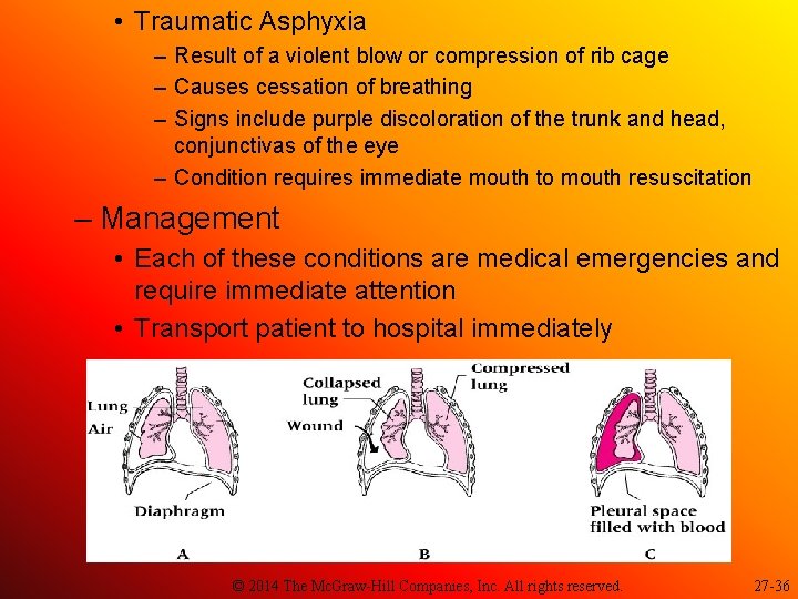  • Traumatic Asphyxia – Result of a violent blow or compression of rib