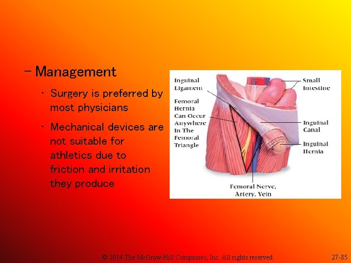 – Management • Surgery is preferred by most physicians • Mechanical devices are not