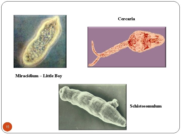 Cercaria Miracidium – Little Boy Schistosomulum 15 