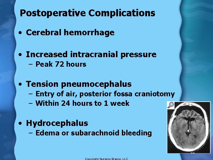 Postoperative Complications • Cerebral hemorrhage • Increased intracranial pressure – Peak 72 hours •