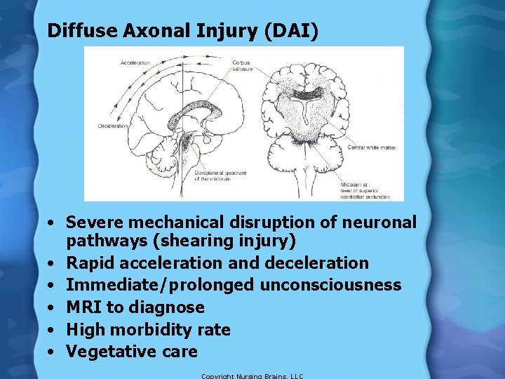 Diffuse Axonal Injury (DAI) • Severe mechanical disruption of neuronal pathways (shearing injury) •