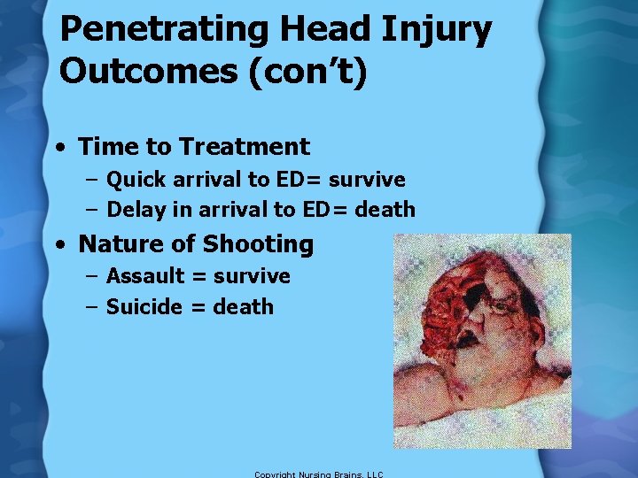 Penetrating Head Injury Outcomes (con’t) • Time to Treatment – Quick arrival to ED=