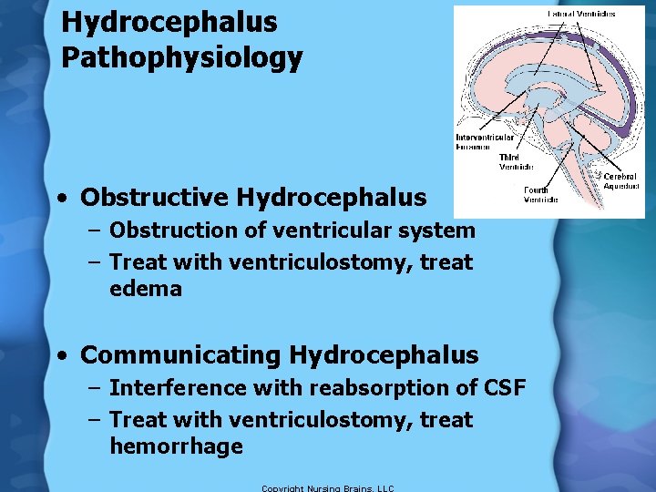 Hydrocephalus Pathophysiology • Obstructive Hydrocephalus – Obstruction of ventricular system – Treat with ventriculostomy,