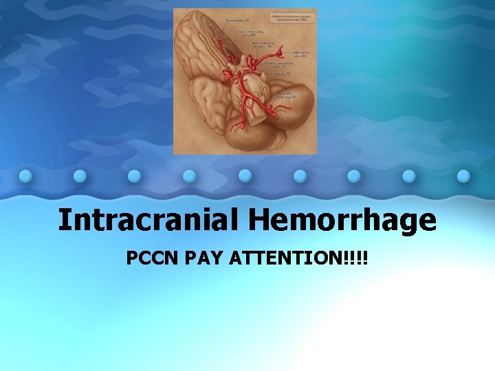 Intracranial Hemorrhage PCCN PAY ATTENTION!!!! 