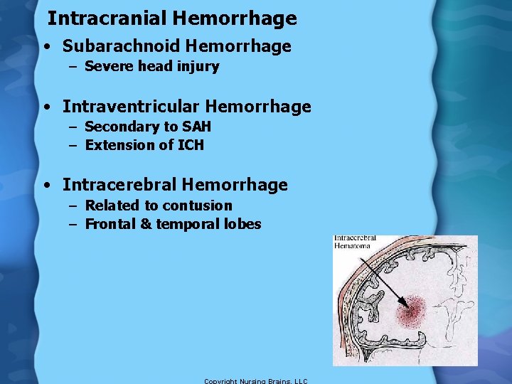 Intracranial Hemorrhage • Subarachnoid Hemorrhage – Severe head injury • Intraventricular Hemorrhage – Secondary