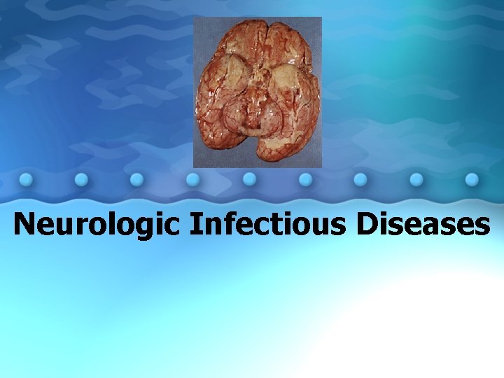 Neurologic Infectious Diseases 