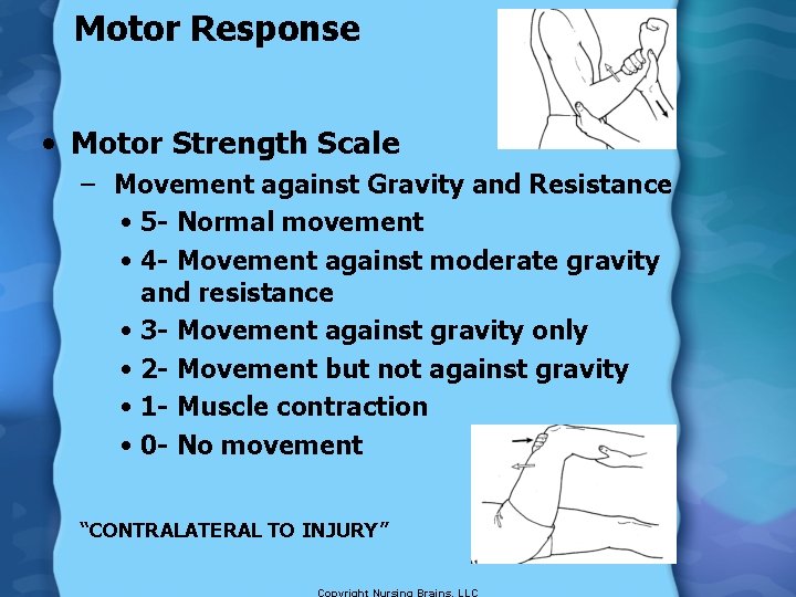 Motor Response • Motor Strength Scale – Movement against Gravity and Resistance • 5