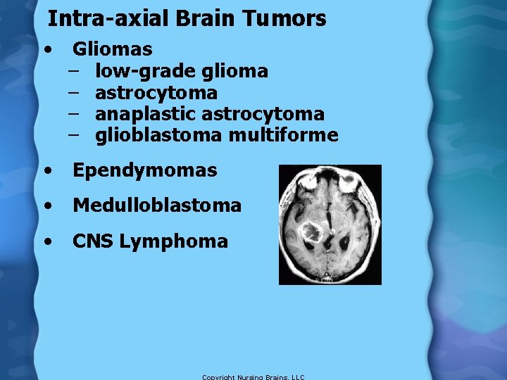 Intra-axial Brain Tumors • Gliomas – low-grade glioma – astrocytoma – anaplastic astrocytoma –