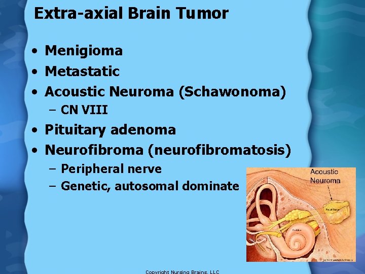 Extra-axial Brain Tumor • Menigioma • Metastatic • Acoustic Neuroma (Schawonoma) – CN VIII