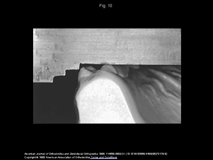 Fig. 10 American Journal of Orthodontics and Dentofacial Orthopedics 1998 114589 -599 DOI: (10.