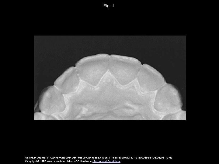 Fig. 1 American Journal of Orthodontics and Dentofacial Orthopedics 1998 114589 -599 DOI: (10.