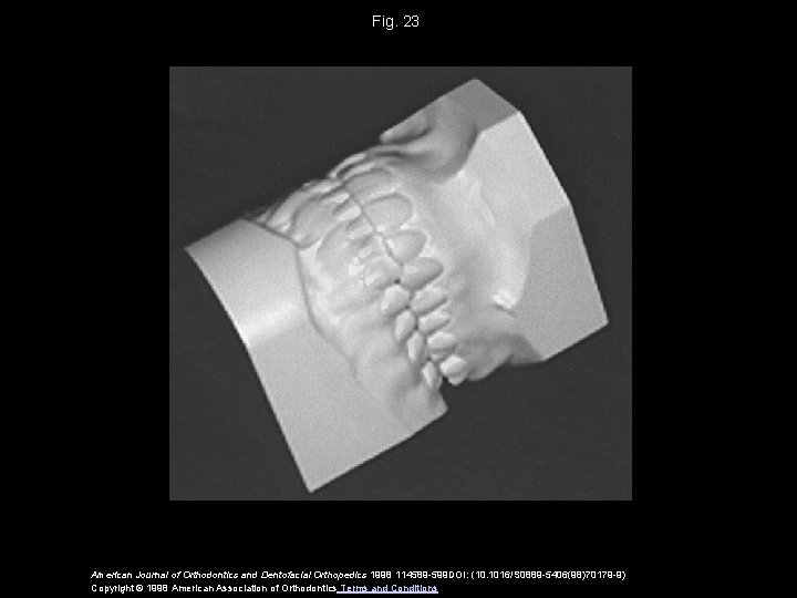 Fig. 23 American Journal of Orthodontics and Dentofacial Orthopedics 1998 114589 -599 DOI: (10.