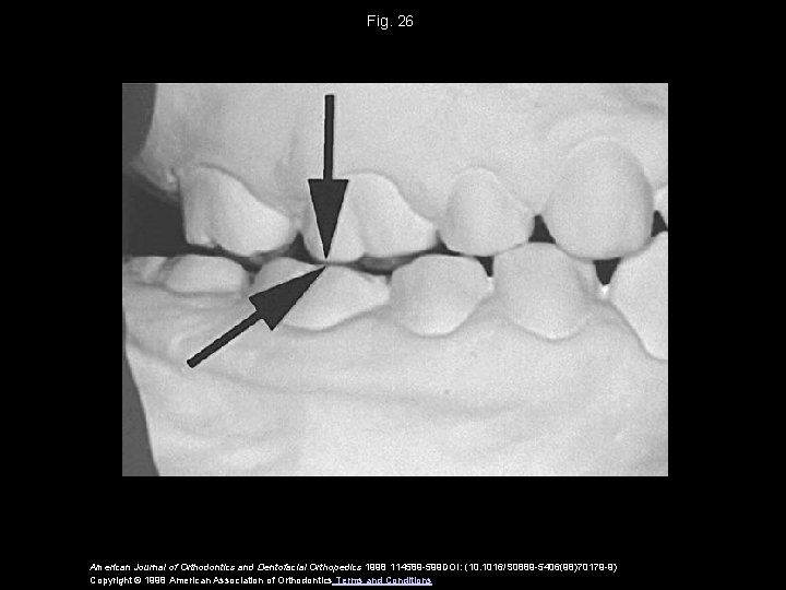 Fig. 26 American Journal of Orthodontics and Dentofacial Orthopedics 1998 114589 -599 DOI: (10.