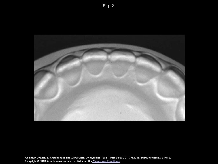 Fig. 2 American Journal of Orthodontics and Dentofacial Orthopedics 1998 114589 -599 DOI: (10.