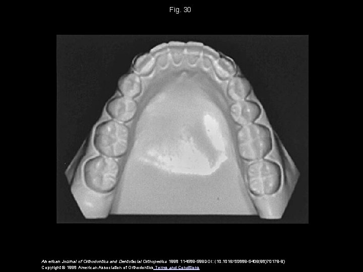 Fig. 30 American Journal of Orthodontics and Dentofacial Orthopedics 1998 114589 -599 DOI: (10.