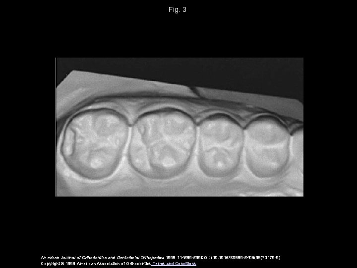 Fig. 3 American Journal of Orthodontics and Dentofacial Orthopedics 1998 114589 -599 DOI: (10.