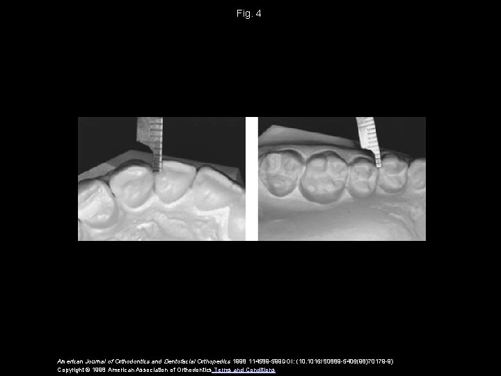 Fig. 4 American Journal of Orthodontics and Dentofacial Orthopedics 1998 114589 -599 DOI: (10.