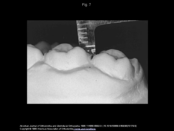 Fig. 7 American Journal of Orthodontics and Dentofacial Orthopedics 1998 114589 -599 DOI: (10.