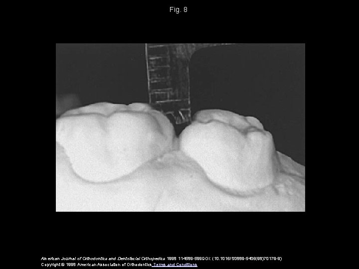 Fig. 8 American Journal of Orthodontics and Dentofacial Orthopedics 1998 114589 -599 DOI: (10.