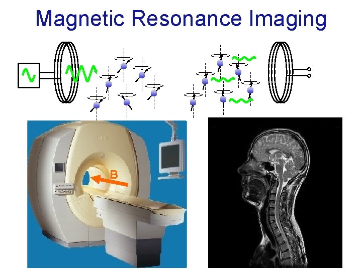 Magnetic Resonance Imaging B 