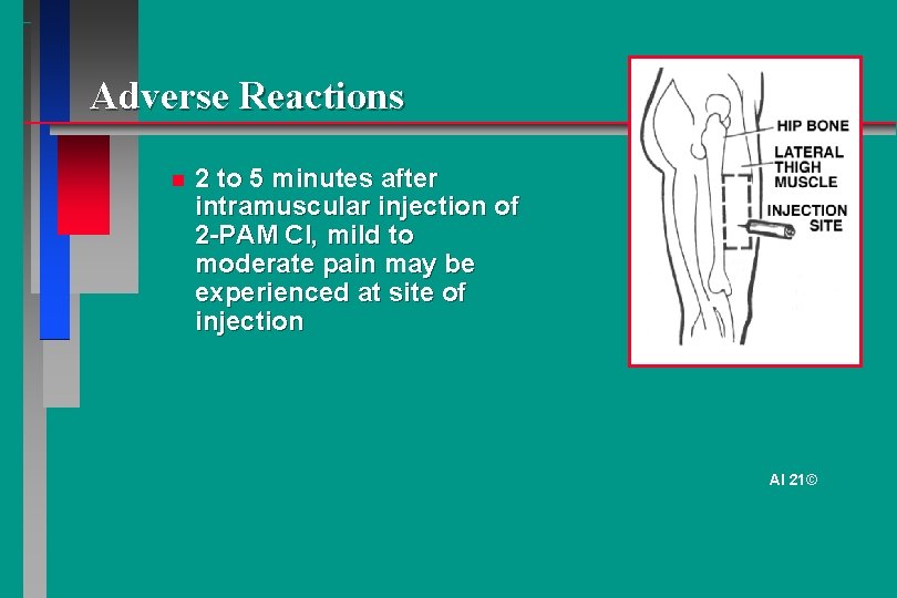 Adverse Reactions 2 to 5 minutes after intramuscular injection of 2 -PAM Cl, mild