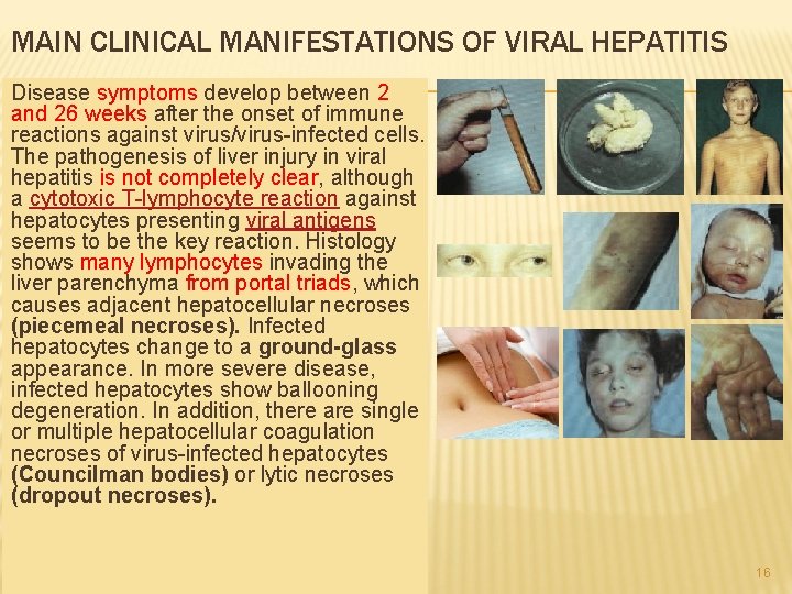 MAIN CLINICAL MANIFESTATIONS OF VIRAL HEPATITIS Disease symptoms develop between 2 and 26 weeks