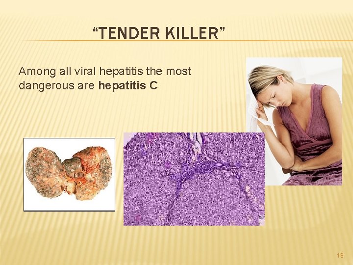 “TENDER KILLER” Among all viral hepatitis the most dangerous are hepatitis C 18 