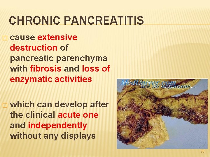 CHRONIC PANCREATITIS � cause extensive destruction of pancreatic parenchyma with fibrosis and loss of