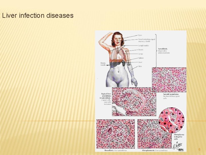 Liver infection diseases 6 