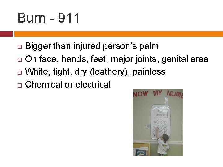 Burn - 911 Bigger than injured person’s palm On face, hands, feet, major joints,