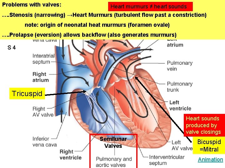 Problems with valves: Heart murmurs ≠ heart sounds …. Stenosis (narrowing) →Heart Murmurs (turbulent