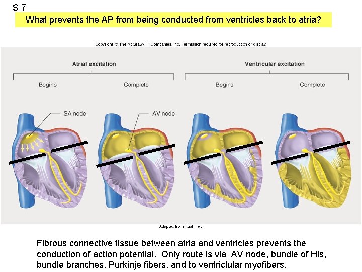 S 7 What prevents the AP from being conducted from ventricles back to atria?