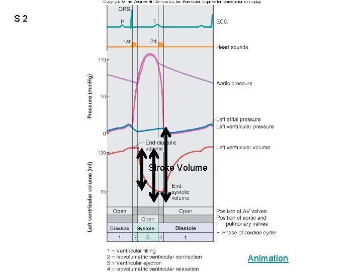 S 2 Figure 12. 20 Stroke Volume Animation 