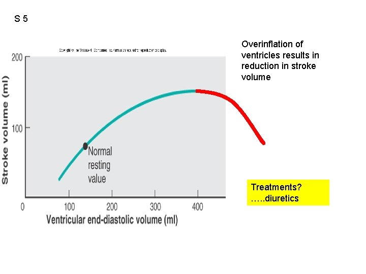 S 5 Overinflation of ventricles results in reduction in stroke volume Treatments? …. .