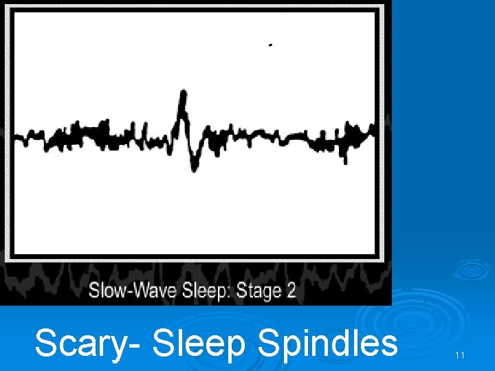 Scary- Sleep Spindles 11 