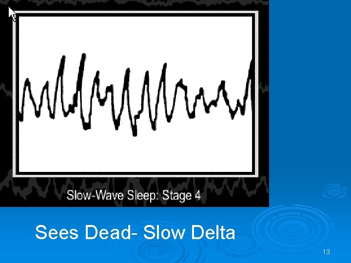 Sees Dead- Slow Delta 13 