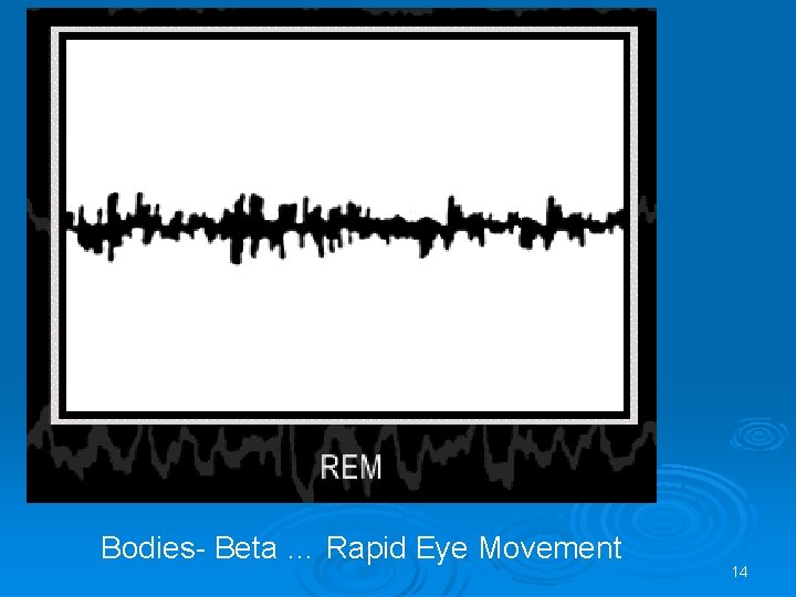 Bodies- Beta … Rapid Eye Movement 14 