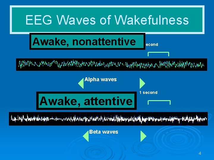 EEG Waves of Wakefulness Awake, nonattentive 1 second Alpha waves Awake, attentive 1 second